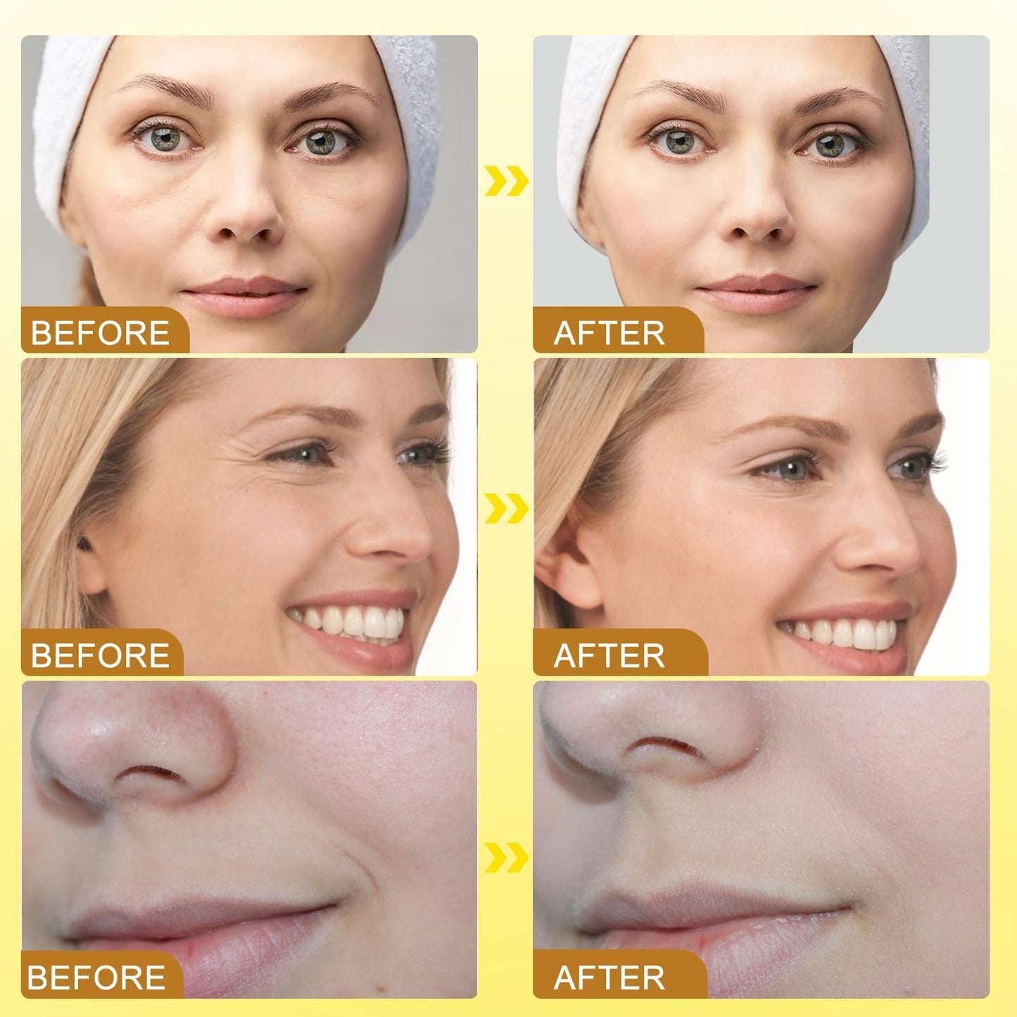 Botox Bee Venom Anti-Wrinkle Cream